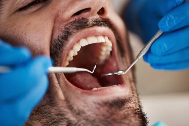 Best Holiday Emergency Dentist in Junction City, CA